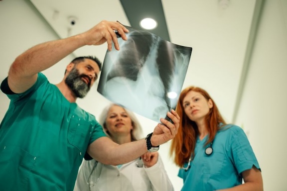 doctors looking at an x-ray