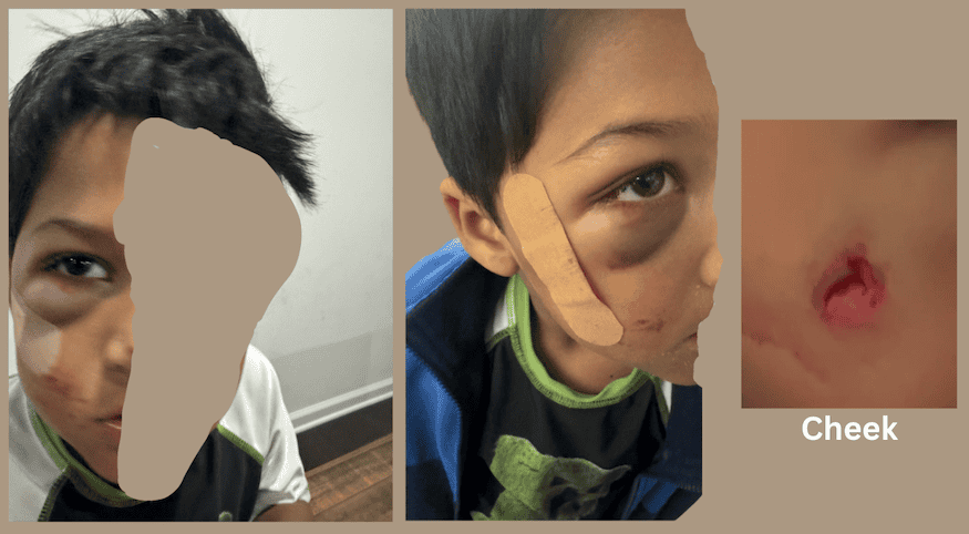 Partially obscured photos of a five-year-old hit by Arun Vellanki while driving his Tesla in Legacy Farm North on September 30, 2025.